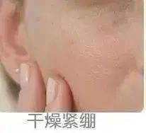 贫民窟|杨幂熬夜后护肤要花2万块？怪不得皮肤吹弹可破！贫民窟女孩就不配消除熬夜痘、黑眼圈吗？