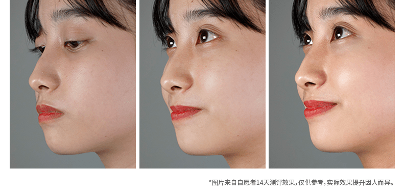 贫民窟|杨幂熬夜后护肤要花2万块？怪不得皮肤吹弹可破！贫民窟女孩就不配消除熬夜痘、黑眼圈吗？