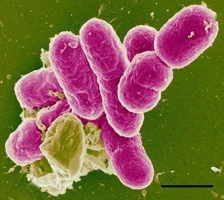 人是如何感染志贺氏菌？1.吃喝感染