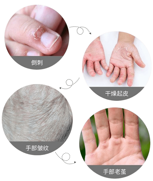 肌肤|因为粗糙的手,丢了颜值还越来越自卑,还好有它拯救了....