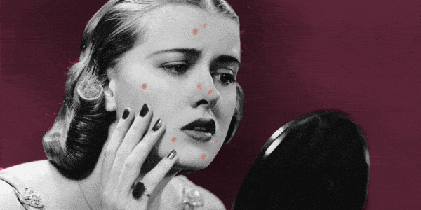 痘痘|夏天变黑长痘不可怕，赶紧用它，让你的皮肤恢复婴儿的光滑，痘痘，黑头，螨虫全都消失了