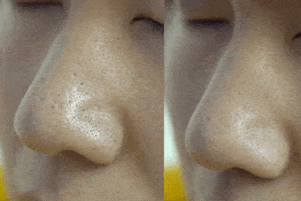 潘达|日本20年老木头,经1300°高温烧成“变态黑炭”,几分钟溶掉黑头,太神奇!