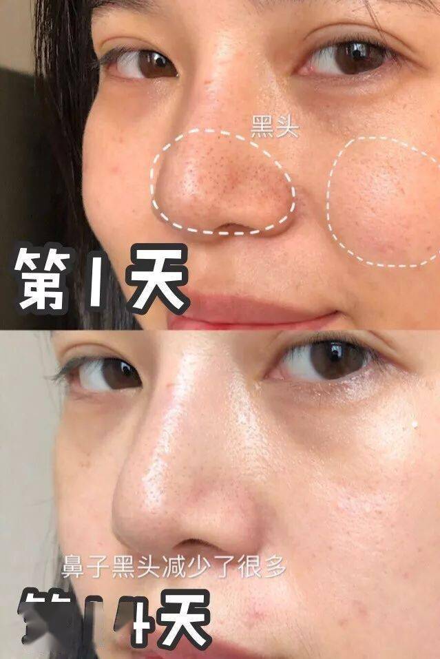 黑头|王霏霏太精明了吧！《浪姐》一播完，立马转行抢主播饭碗了？