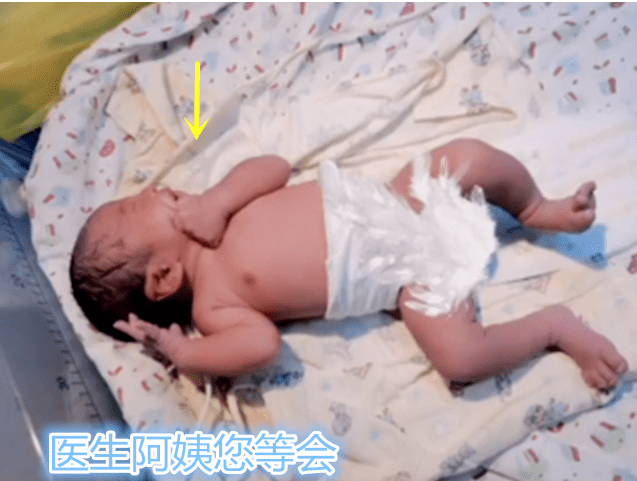 宝宝|把自己掐哭：不用动手我自己来新生宝宝怕被医生“打”