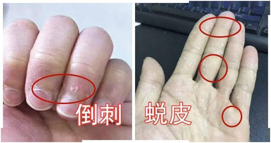 用什么方法可以养手 58e60de9da164e9189eb3dc5badfafbb.jpeg