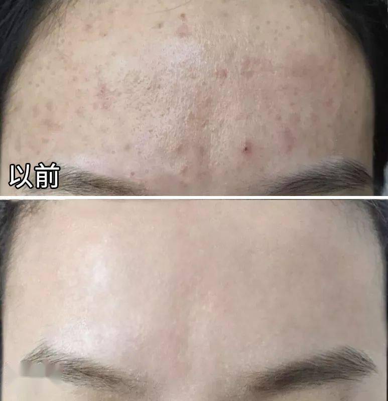 日本|日本黑科技泡脚汤药,竟让全民女人1个月瘦20斤!暴汗排湿还嫩肤助眠!