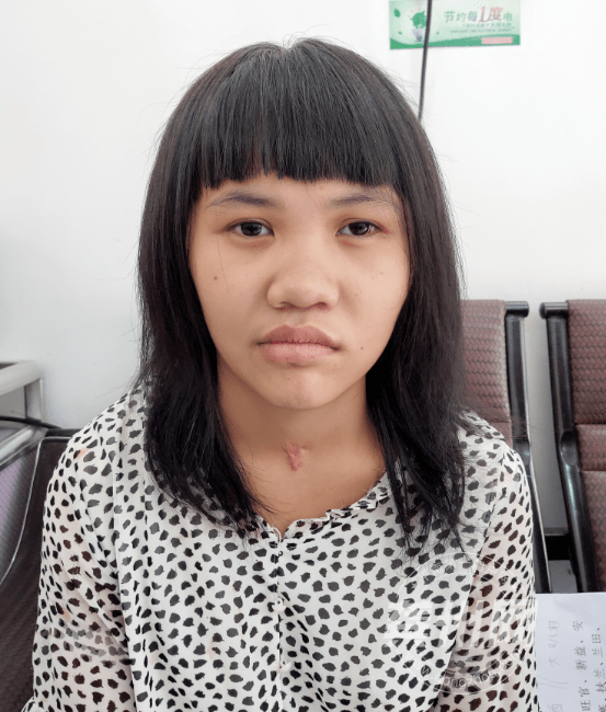 寻亲启事 | 女孩颈部有个疤痕,疑似平南或桂平人,急寻