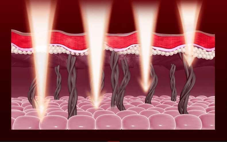 美容|以色列美容仪太牛！千万红人都用它提拉、导入、清洁，还有18K真金护理头