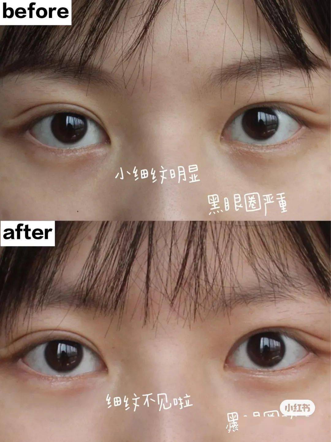 禾葡兰|庄里爱美仙女必看！明星都在用的眼膜液，仅需7.7元！