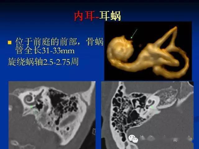 耳部ct及mri解剖