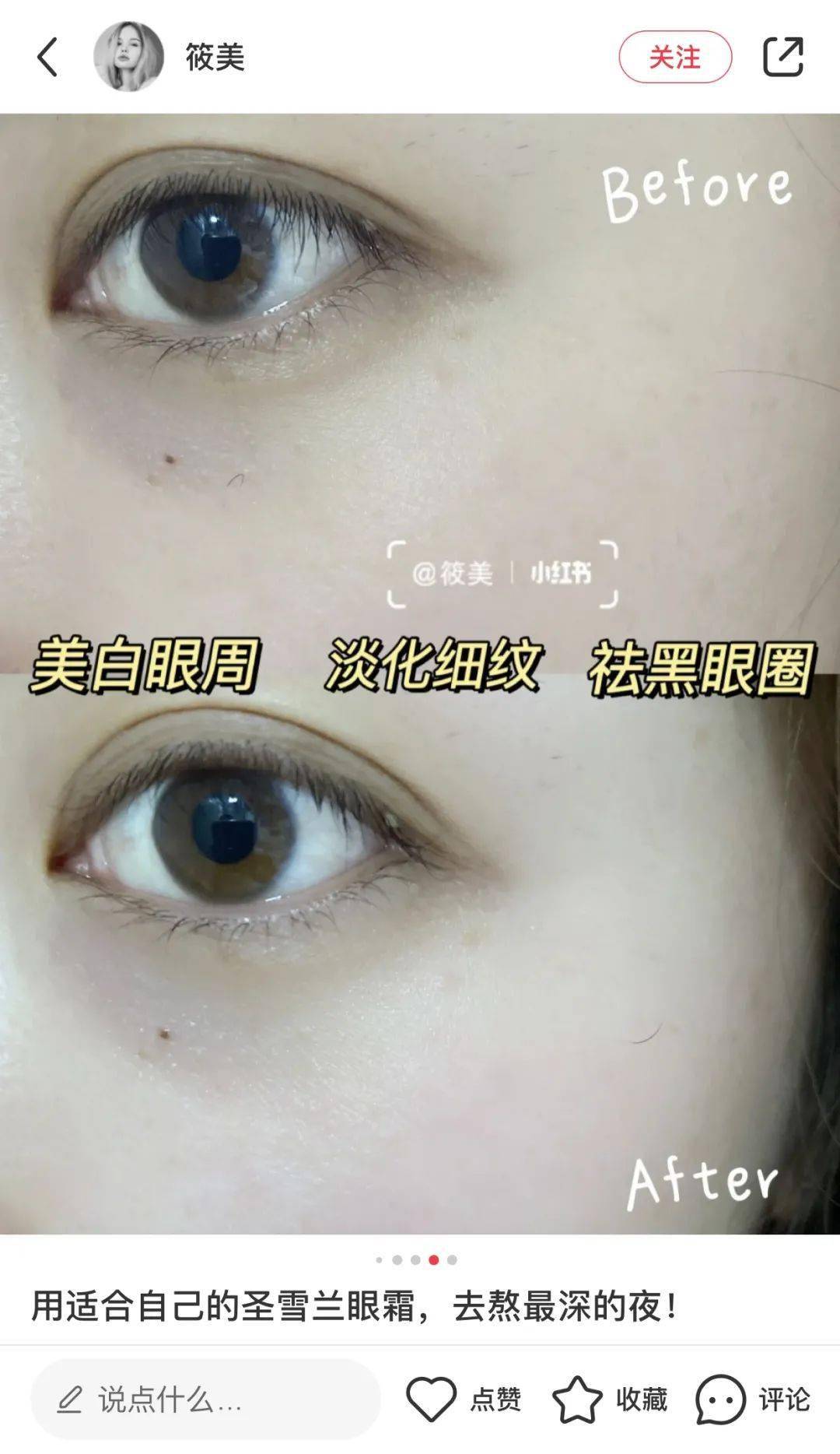 黑眼圈|实名推荐这款国货眼霜,99元去掉20年的熊猫眼,还不长脂肪粒!