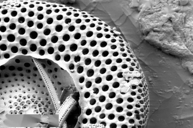 张天|长期闭口、粉刺、痘痘满脸的人，微镜头下毛孔竟然是这样的！赶紧get林允、张天爱的0毛孔秘籍吧！