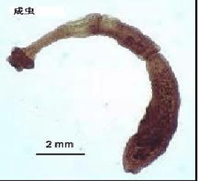 地方病防治宣传核心信息碘缺乏病包虫病地方性氟中毒