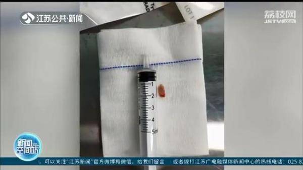 排骨|万不可大意！粗心家长喂排骨 八月龄婴儿命悬一线
