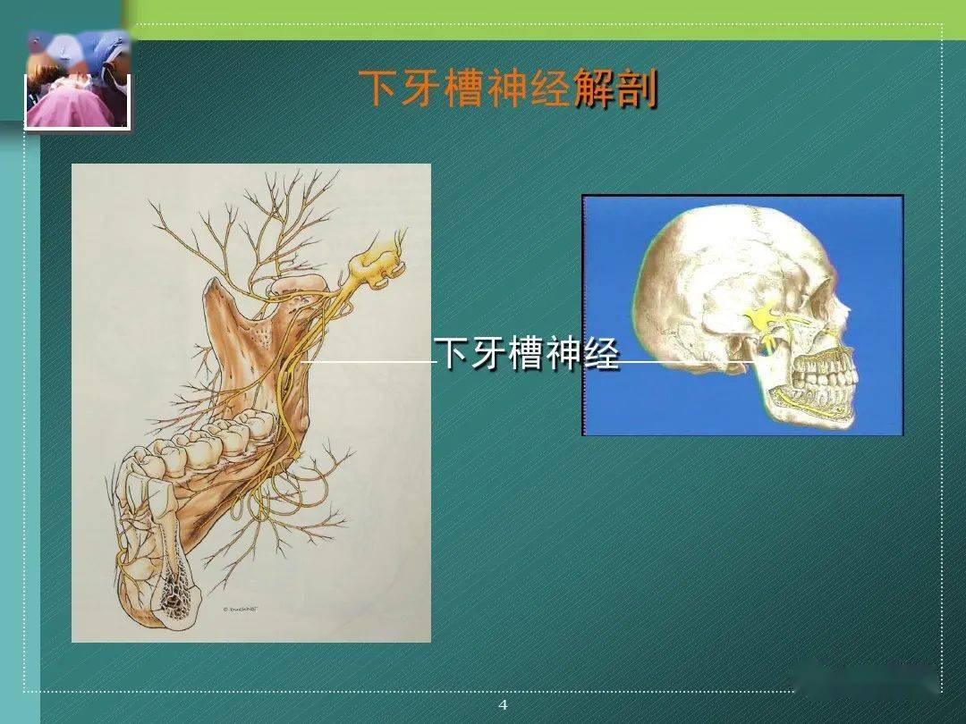 下牙槽神经阻滞麻醉