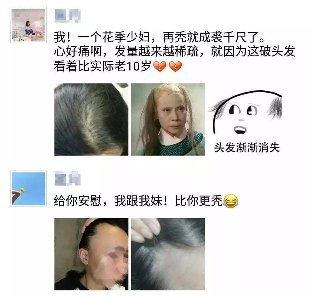 头皮|头发竟然都长出来了！后退的发际线，真的还可以再救一下！