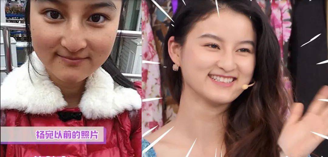 皮肤|刷酸=换脸？这个明星们超爱的百元刷酸好物搞定你的痘痘、闭口、黑头毛孔粗大还不怕烂脸！