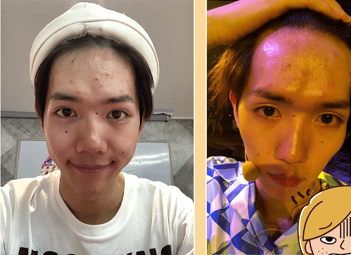 皮肤|刷酸=换脸？这个明星们超爱的百元刷酸好物搞定你的痘痘、闭口、黑头毛孔粗大还不怕烂脸！