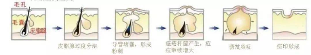 泡沫|让你爱上洗澡,1瓶才20出头,开启你的专属泡泡浴!