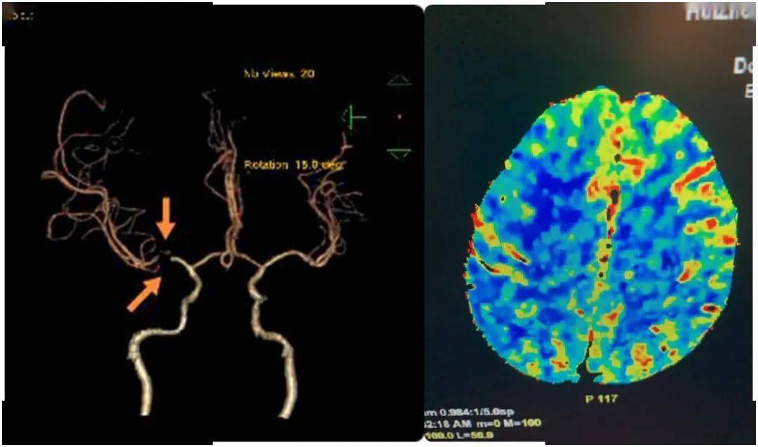 蓝色的血迹 a4a242bfaf8744819c1a7cbb17dcc024.jpeg