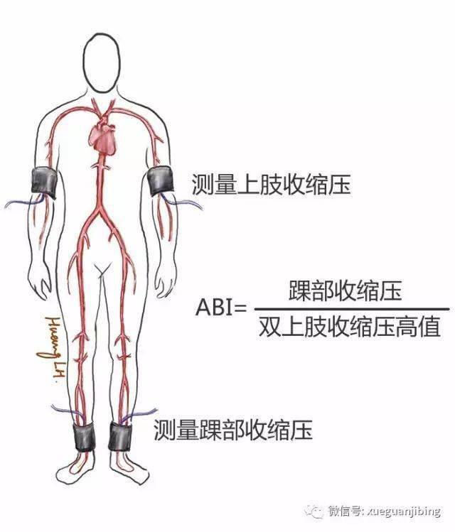 是踝部动脉收缩压和肱动脉收缩压的比值.