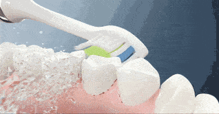 口腔|不到60元的电动牙刷，用起来竟然不输百元大牌！2分钟清洁整个口腔，性价比逆天！