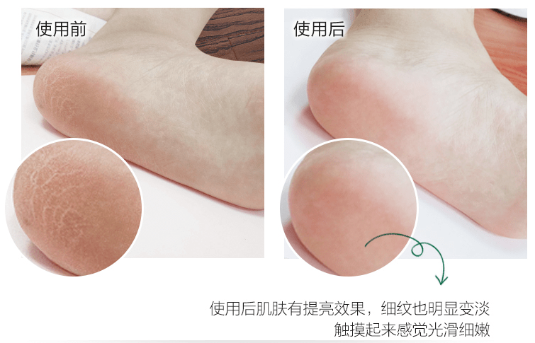 拖鞋|爱穿凉鞋、拖鞋出门的女人,脚上露出这个东西也太丑了吧~