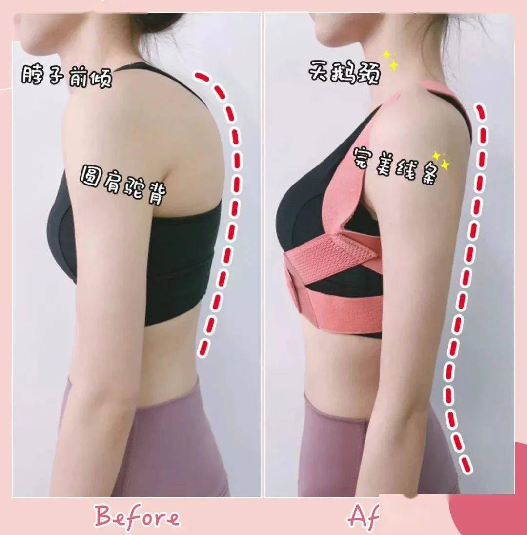 矫姿|好体态，胜过好容颜丨好物