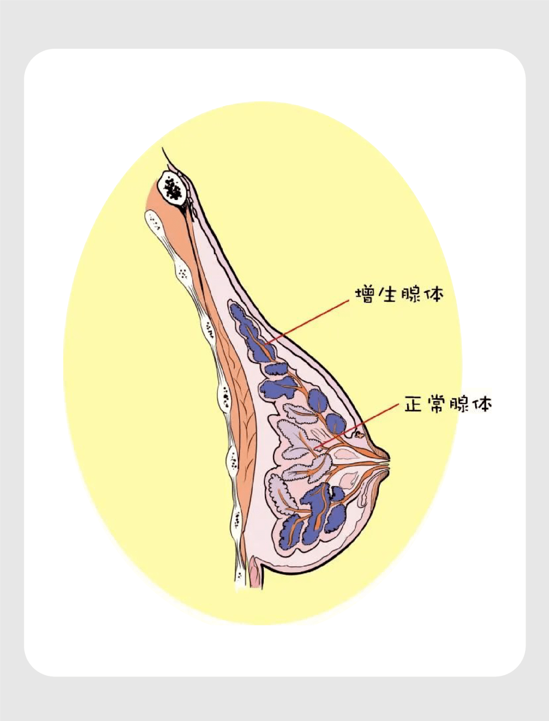 10个女生7个乳腺增生这些乳房的秘密80的女性都不知道