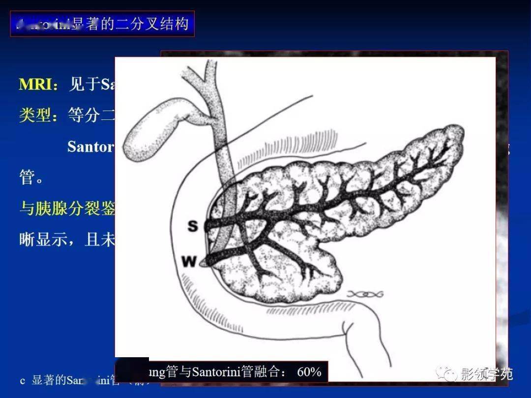 胰腺的解剖与常见变异