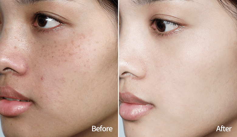 鼻血|“越南杨幂”因太性感被封杀！15秒片段疯传，吸500万人围观：鼻血止不住……