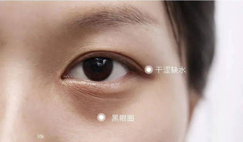 黑眼圈|430年的马应龙放大招,八宝古方做的眼霜,眼纹淡了