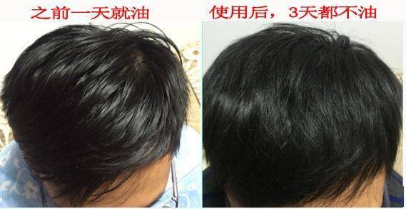 洗头|拯救细软塌,一喷一揉,头发随意蓬!