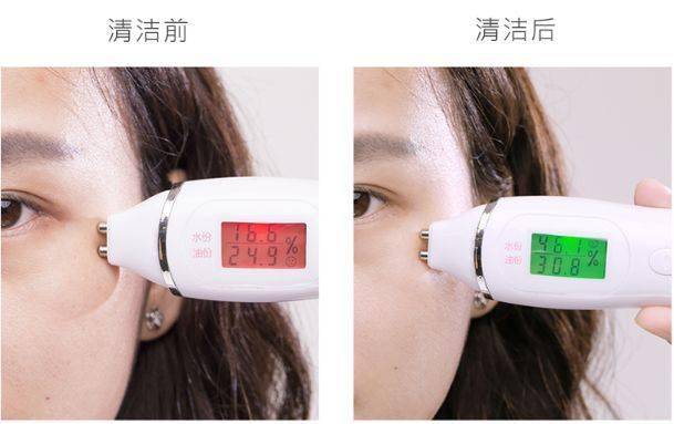 氨基酸|拒绝“螨虫脸”，5秒揉一揉，螨虫全出来了，痘痘黑头全没了！