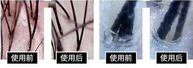 品牌|热销260万个的菊星洗发皂，日本天皇御用品牌，轻松搞定油腻脱发！