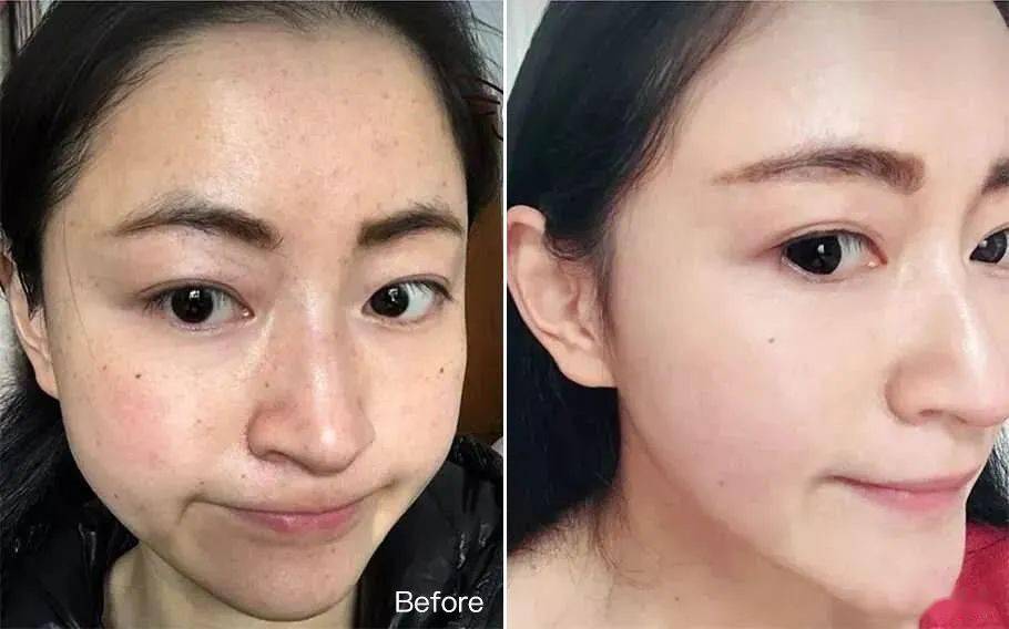 女人|如果你正长“色斑”,试试这个新方法,惊喜到让你尖叫!