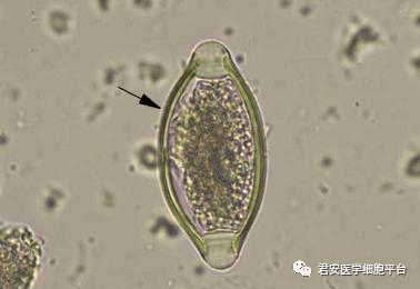 请报告箭头所指寄生虫虫卵 的名称(大小约为140um×80um) 布氏姜片