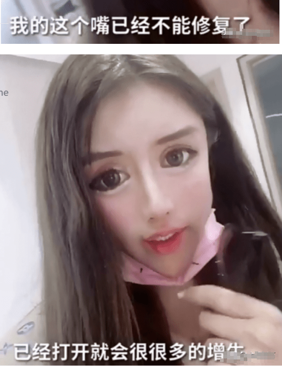 双眼皮|“我花了100万，把女儿整成了残废”：暑假整容风潮后，有20万女孩正在消失……