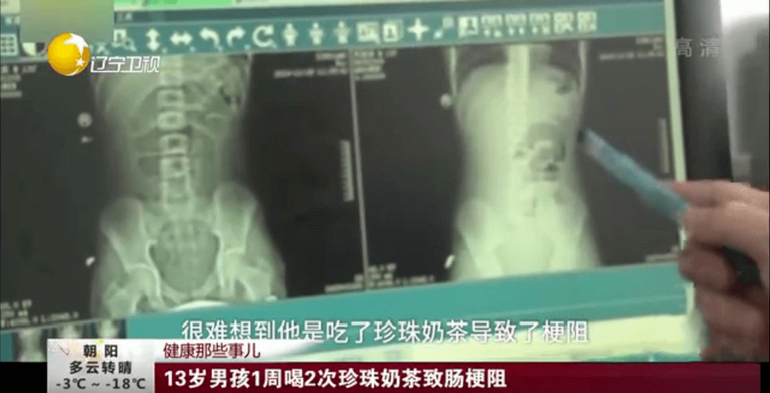 孩子|我不阻止孩子喝饮料,但这5类?被列入“黑名单”的,少给孩子喝吧