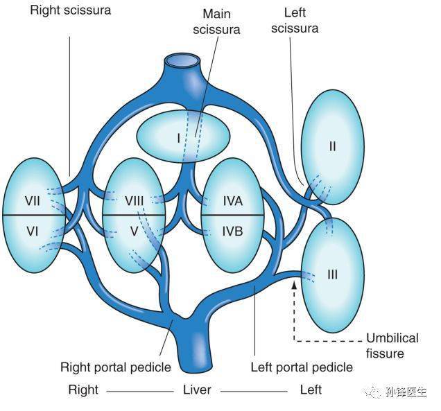 门静脉15mm怎么办