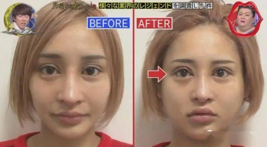 妹子|霓虹妹子整容上百次＂走上人生巅峰＂，以后还想整成桥本环奈…