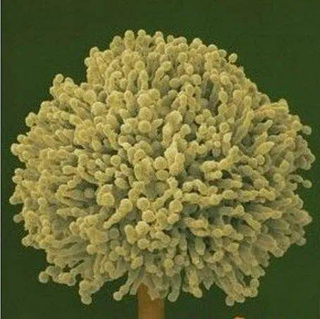 菜板发霉还能吃吗 a29513c3e14c489094ba2ac611a57917.jpeg