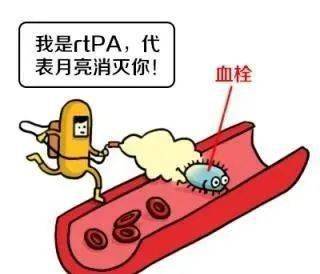 静脉溶栓——急性脑梗的福音!