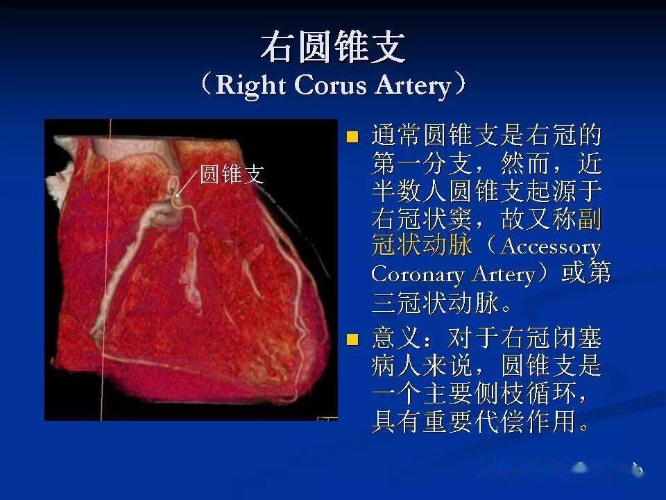 详细解读冠状动脉及冠心病ct