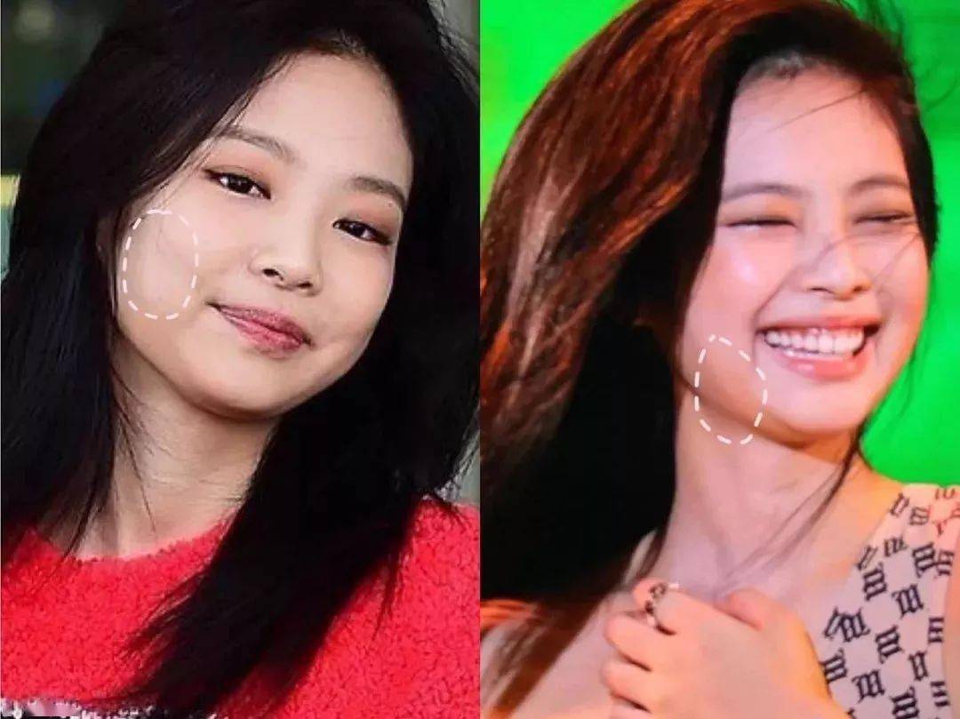 鹅蛋脸|肉脸还是大脸?选对发型你就是鹅蛋脸!