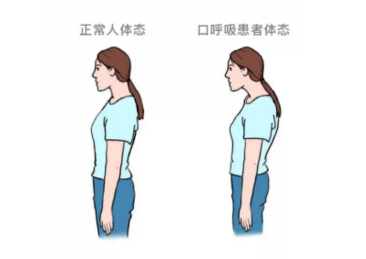 327a6d45781f446cbe0f22d05eca3ddf.png