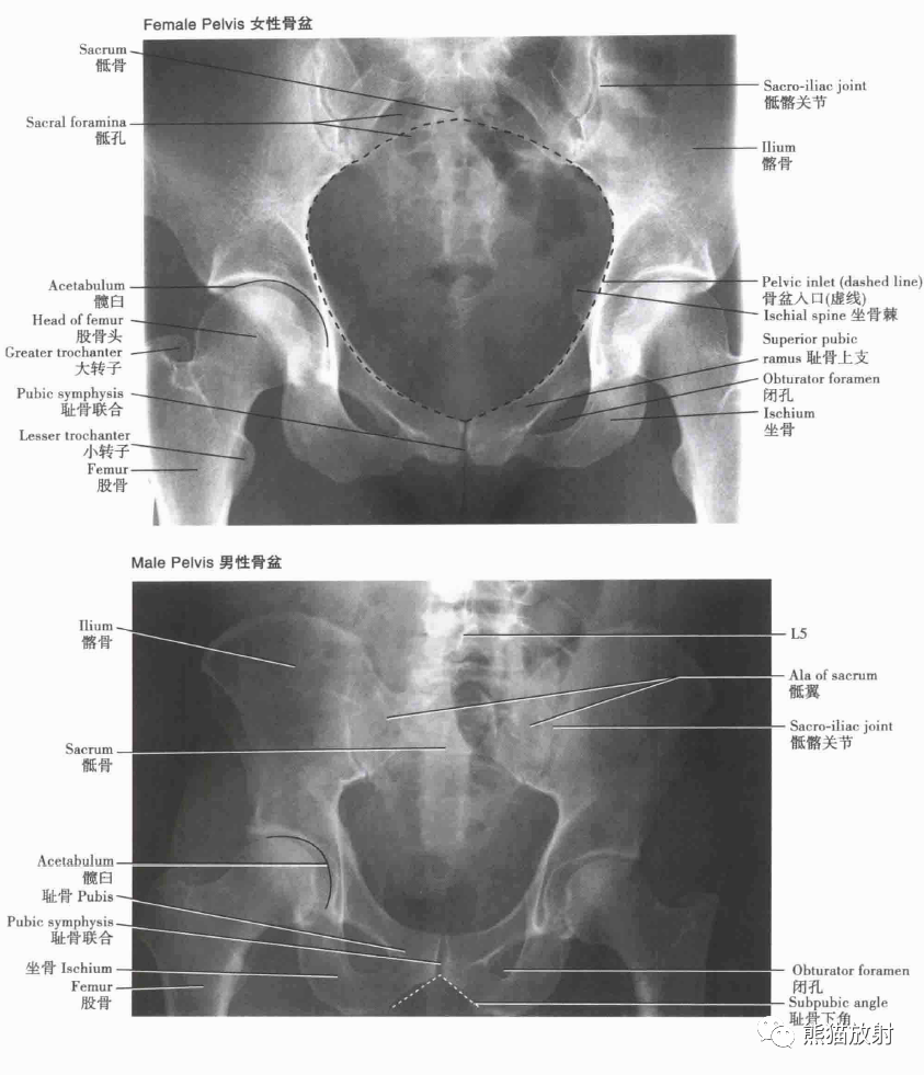 解剖丨骨盆,盆膈(女/男)