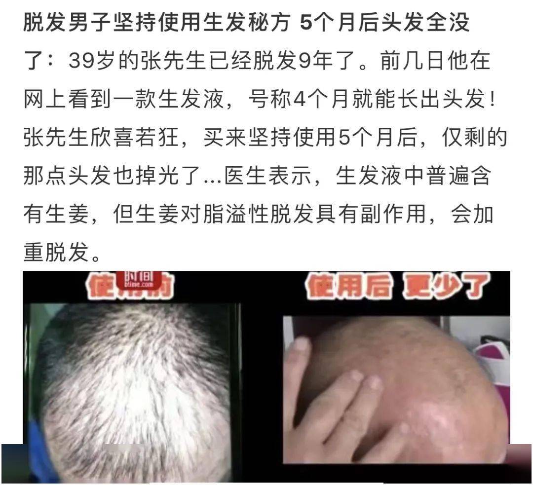 宝藏|头发一把把掉？这个土耳其宝藏固发神器，竟然一步搞定防脱、控油、去屑！