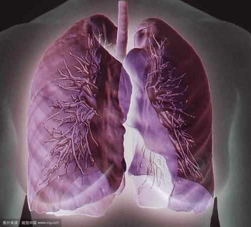 低剂量肺ct,用更少的x光剂量检查早期肺癌小结节!| 健康课堂