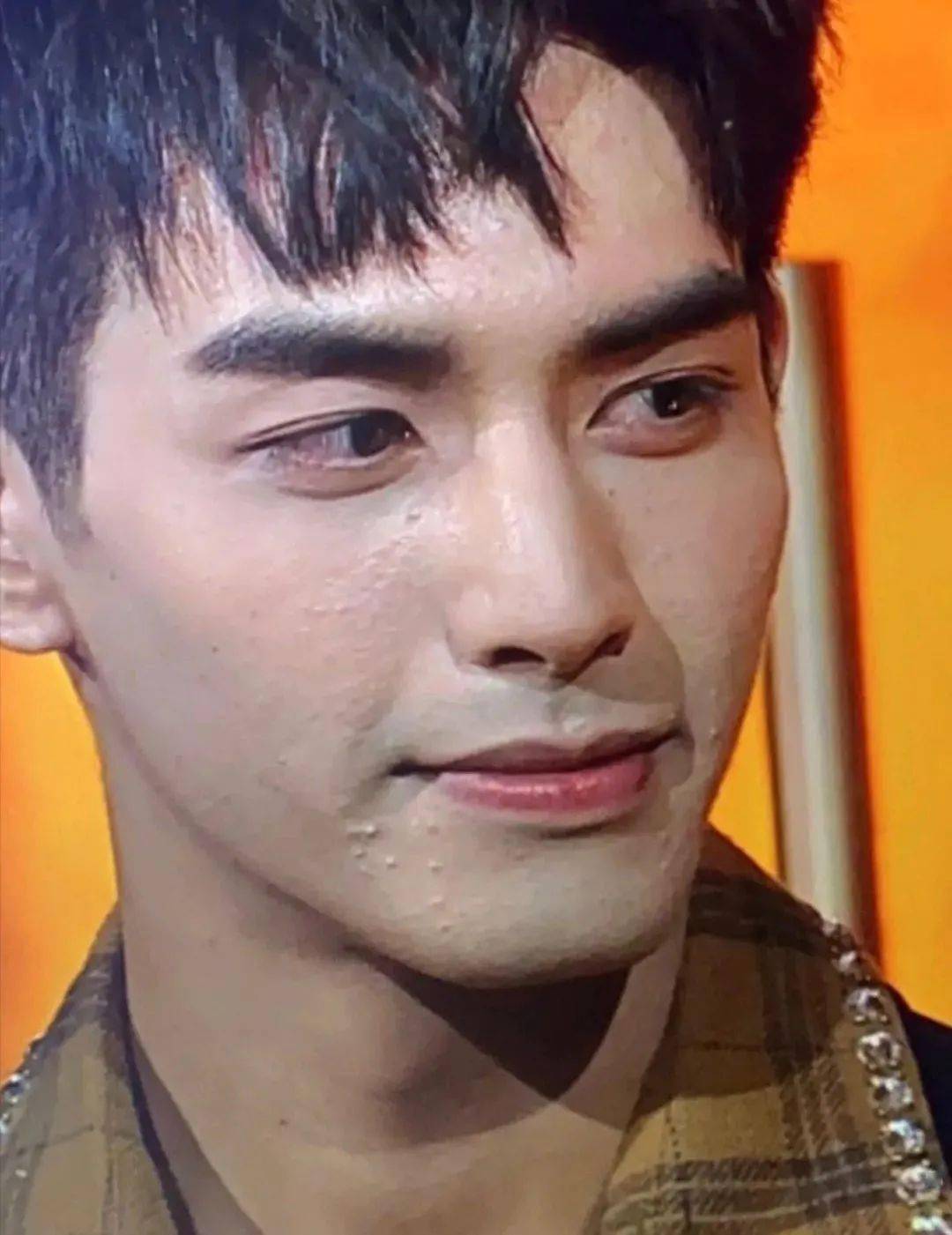 金鹰节|这位小鲜肉要演《以痘痘之名》?